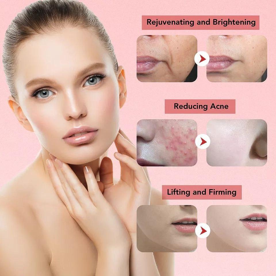 BeautyRevive Pottenza 7in1 LiveLux Уред За Дълбоко Почистване и Подмладяване на Кожата - снимка 4